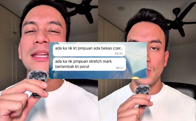 ‘Stretch Marks, Bekas Caesar Bukan Kecacatan & Kekurangan Tapi Lambang Kekuatan’