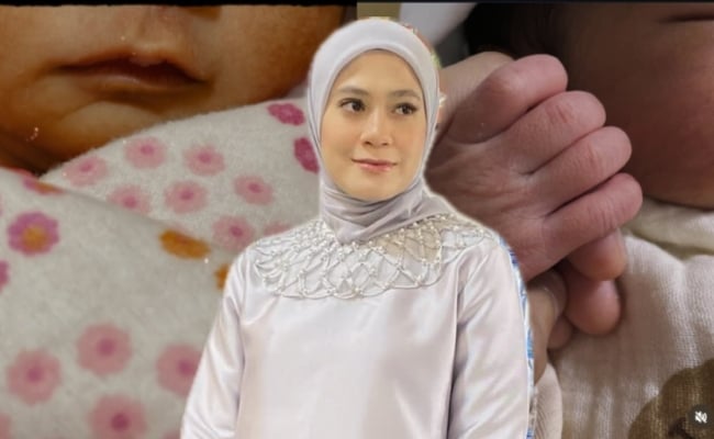 Fara Salleh Selamat Melahirkan Bayi Perempuan, Tiga Hari Bertarung Nyawa