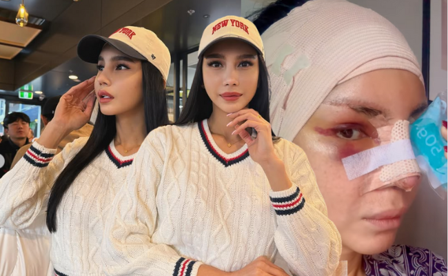 Nur Sajat Ditegur Buat Hidung, Netizen Mohon Bertaubat – ‘Saya Bukan Ingin Mengubah’