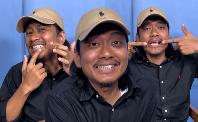 Ryan Bakery Nak Pakai ‘Braces’, Struktur Gigi Hadapan Berterabur
