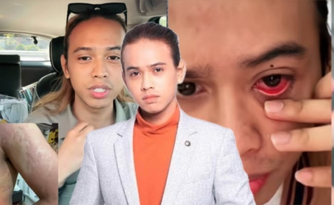 [VIDEO] Uciluna Pernah Diuji Seperti Aliff Syukri Ketika Bisnes Meningkat – ‘Setiap Kali Live, Badan Penuh Kemerahan’