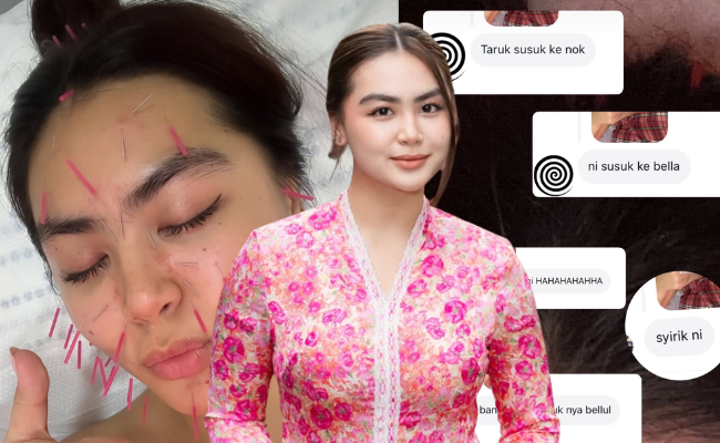 ‘Bukan Susuk Lah, Tapi Rawatan Akupuntur’ – Bella Dowanna
