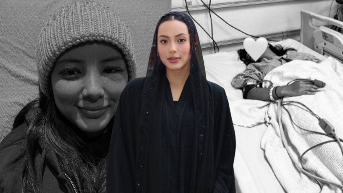 Ezzanie Jasny Tangguh Percutian Ke London, Muka Masih Bengkak & Alami Pendarahan Di Sekitar Tengkorak