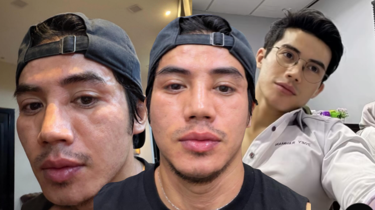 ‘Bangun Tidur Muka Bengkak & Panas, Mungkin Alahan Makanan Berbuka Puasa’ – Zoey Rahman