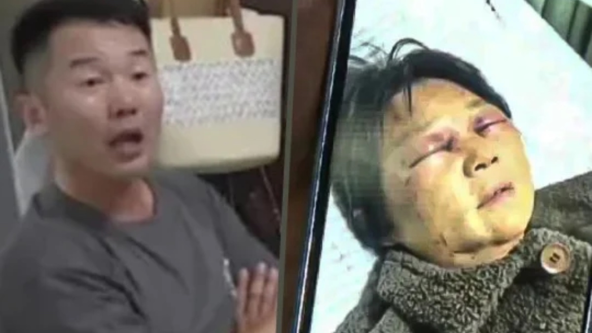 Enggan Jaga Cucu, Warga Emas Dipukul Menantu Sampai Patah Tulang Rusuk