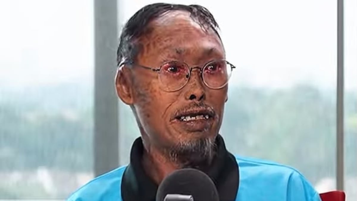 [VIDEO] Lelaki Penghidap Penyakit Iktiosis Kongsi Cabaran Hidup – ‘Orang Tak Boleh Tengok, Mereka Takut Berjangkit’