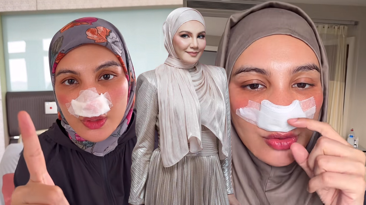 Shahida Jalani Pembedahan Hidung Akibat Sinus – ‘Mata Kerap Bengkak, Hidung Tersumbat & Selalu Bersin’
