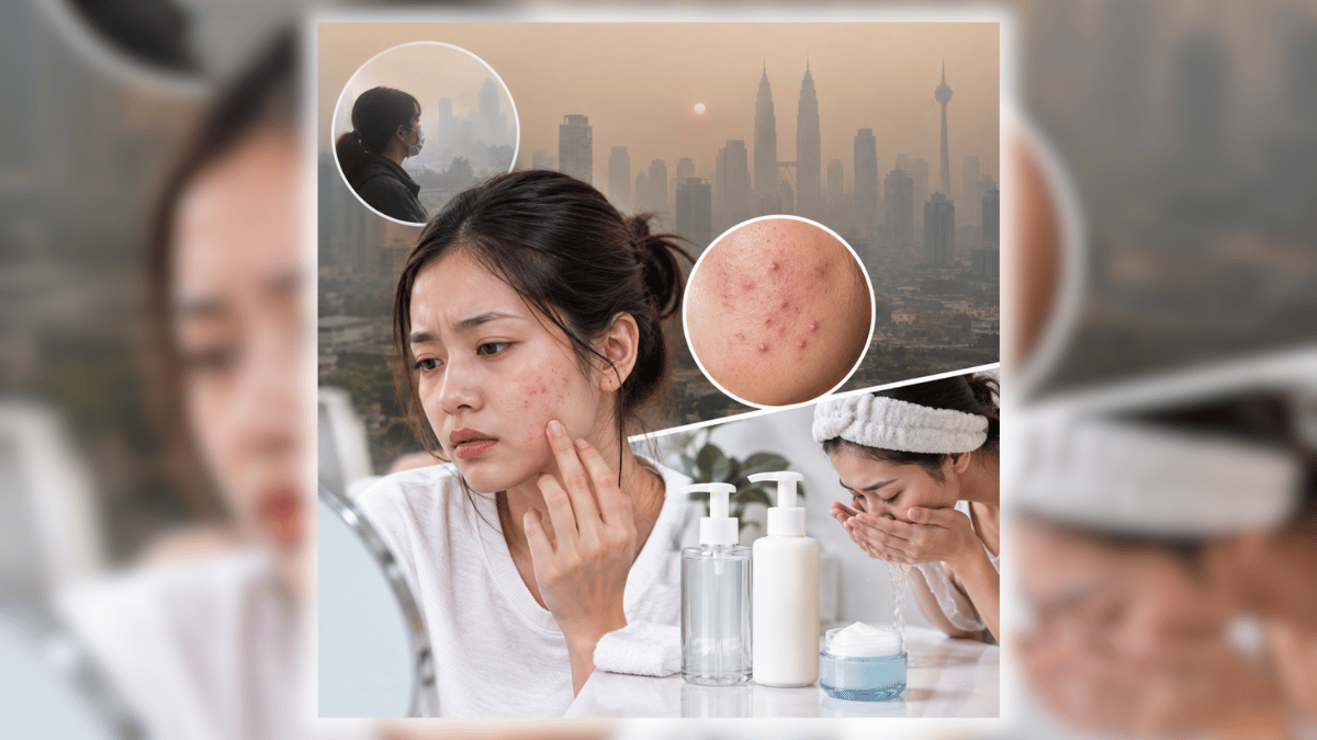 Jerebu Punca Jerawat Cepat Naik, Doktor Kulit Bagi Tips – ‘Double Cleasing Setiap Malam, Guna Ceramide Moisturizer’